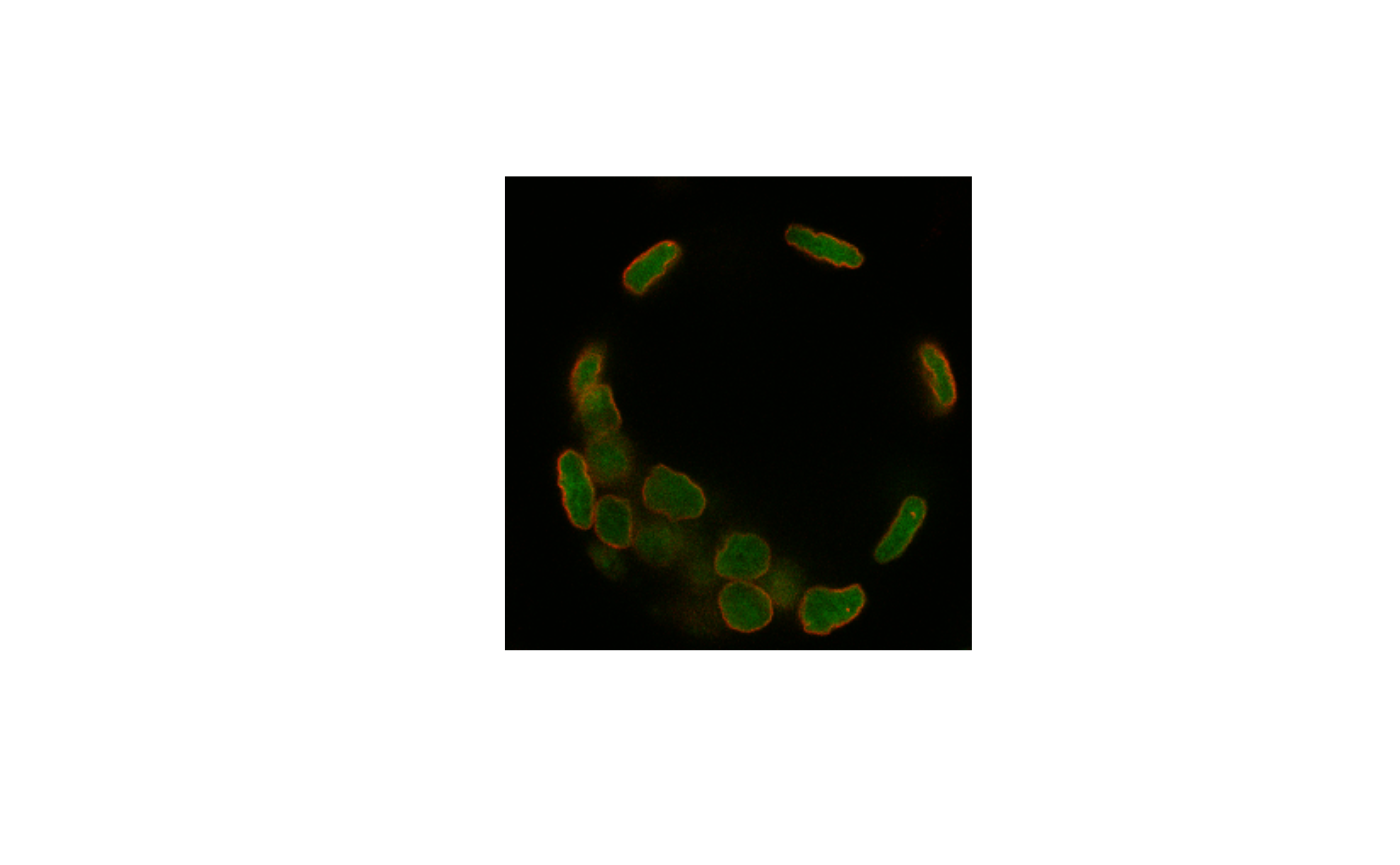 Two-channel fluorescence microscopy Z-plane rendered as a red and green composite.